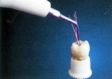 endo E3_2